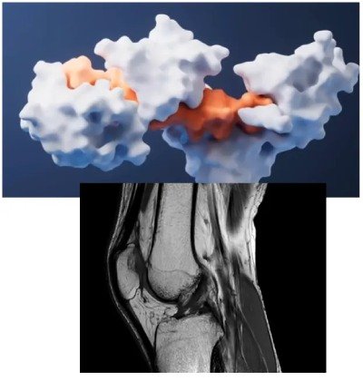 Joint Glide joint support